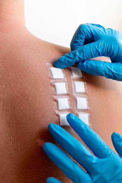 skin-allergy-reaction-person-s-back